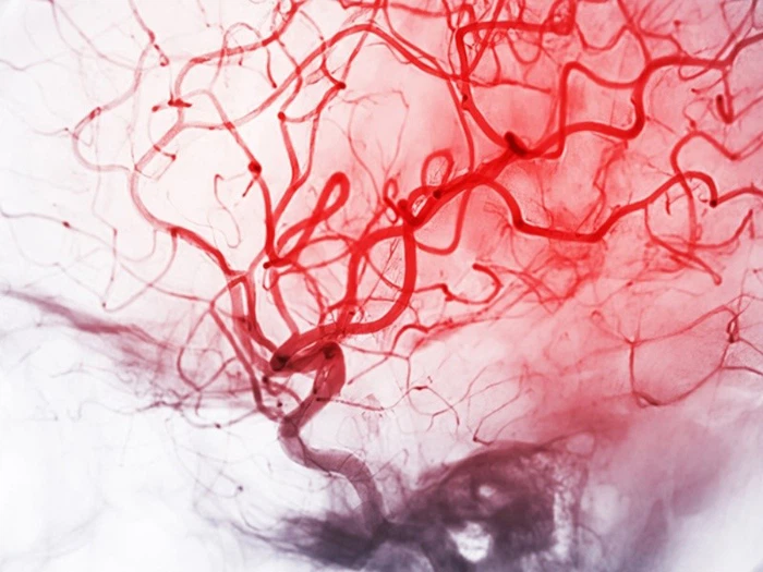 Idebenone Other Neurological Disorders | Shaanxi BLOOM Tech Co., Ltd Idebenone Other Neurological Disorders | Shaanxi BLOOM Tech Co., Ltd